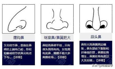 白色鼻毛面相|鼻相分析10款｜鼻樑有節及橫紋、豬膽鼻、鼻頭下垂代表甚麼？姻 